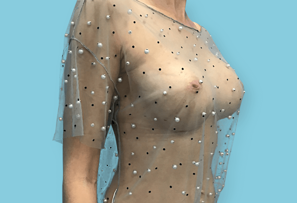 Symetryzacja przez powiększenie różnymi implantami oraz podniesienie i redukcje piersi